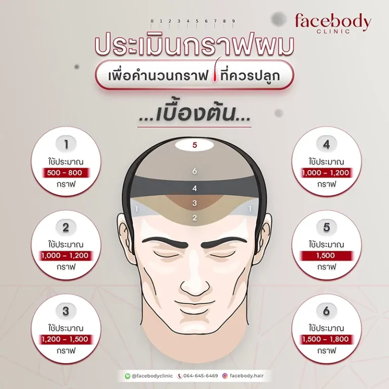 ประเมินกราฟผม บริเวณที่ปลูกผม
