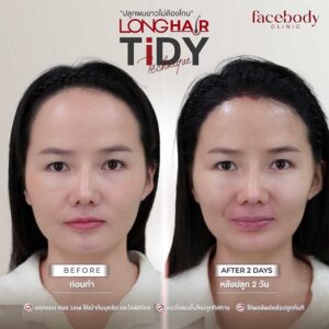 Facebody hair LONG HAIR 2