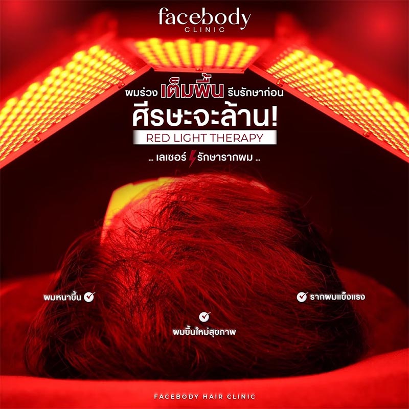 เลเซอร์ LED ป้องกันผมร่วง