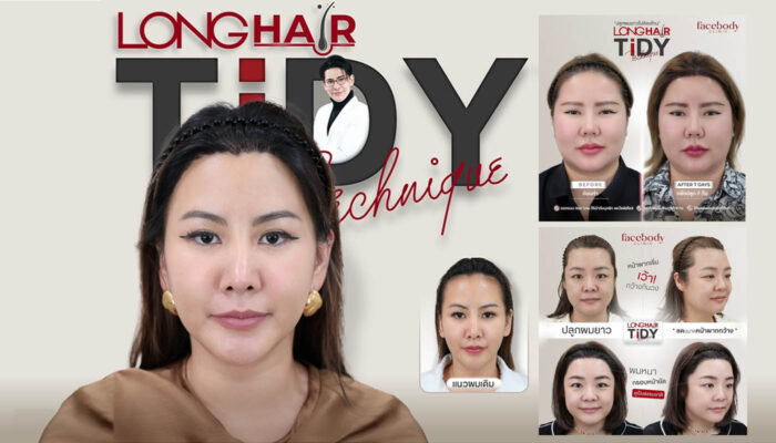 BANNER ปลูกผมผู้หญิง FACEBODY