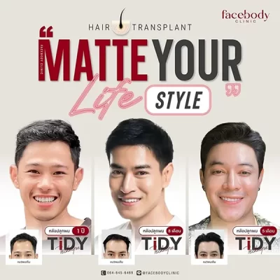 MATTE YOUR LIFE STYLE by FACEBODY 1