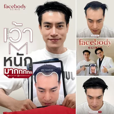 MATTE YOUR LIFE STYLE by FACEBODY 17