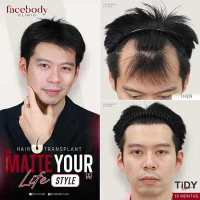 MATTE YOUR LIFE STYLE by FACEBODY 2