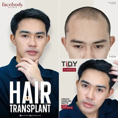 MATTE YOUR LIFE STYLE by FACEBODY 3