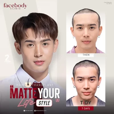 MATTE YOUR LIFE STYLE by FACEBODY 6