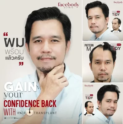 MATTE YOUR LIFE STYLE by FACEBODY 9