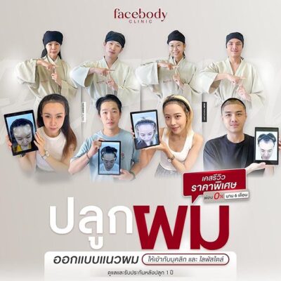 ปลูกผม 2568 tabled