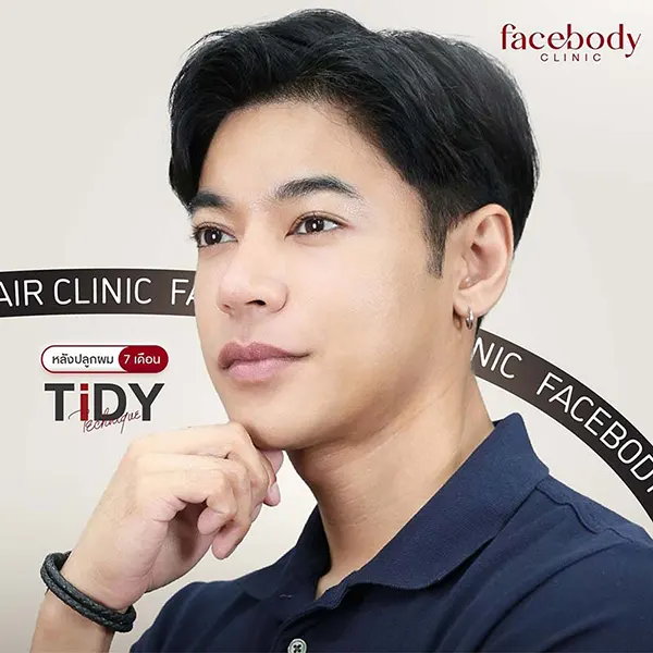 ปลูกผมถาวร TiDY
