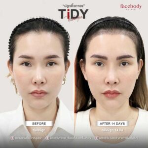 ปลููกคิ้ว ผู้ผญิง