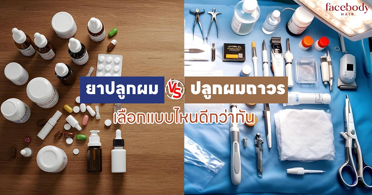 ยาปลูกผม หรือ ปลูกผมถา