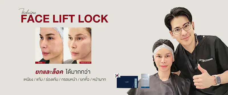 M ร้อยไหม