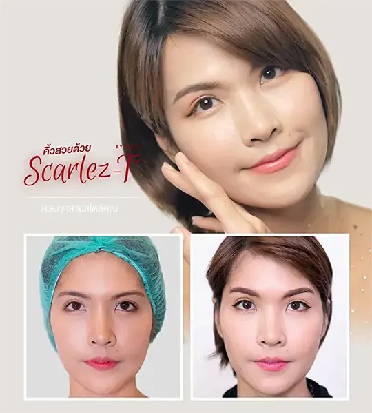 greating แก้เป็นคิ้วสวยหมด ใหม่ 2 540