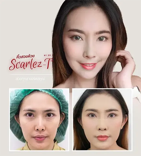 greating แก้เป็นคิ้วสวยหมด ใหม่ 5 540