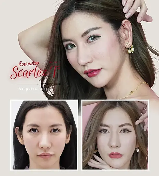 greating แก้เป็นคิ้วสวยหมด ใหม่ 540