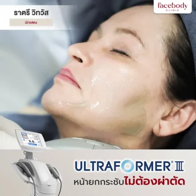 พรีเซนเตอร์ 4