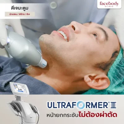 พรีเซนเตอร์ 5