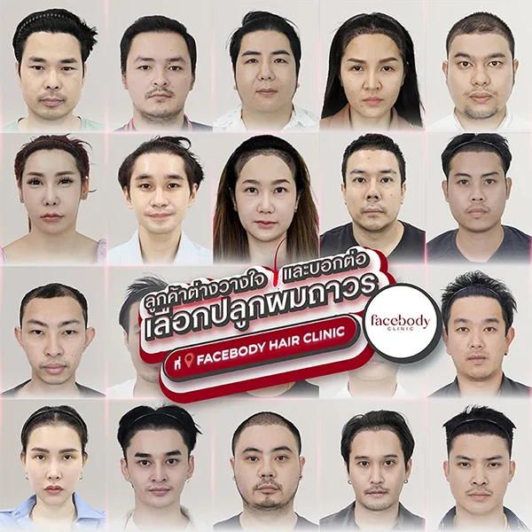 ลูกค้าไว้ใจ Facebody