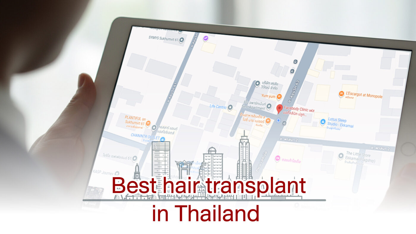 Hair Transplant in Bangkok: Which Clinic Is the Best? 1 Best hair transplant in Thailand