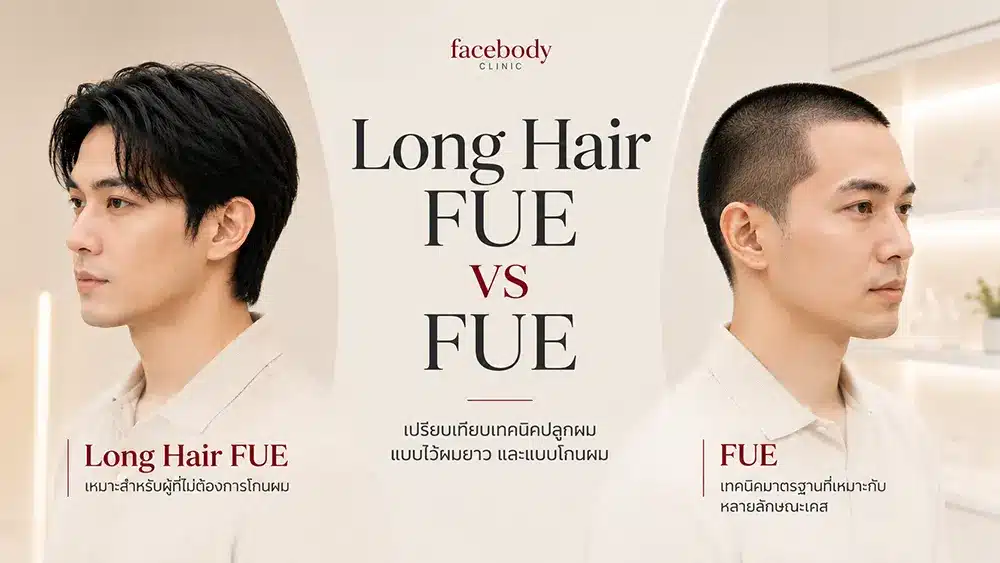 long-hair-fue-vs-fue