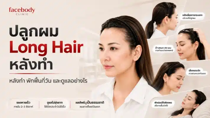long-hair-after-care หลังปลูกผมเทคนิค long hair ที่ facebody clinic ด้วยเทคนิค long hair ฟื้นฟูแนวผมอย่างเป็นธรรมชาติ เพิ่มความมั่นใจในทุกมุมมอง ดูหนา ดูสวย แบบไม่ต้องปิดบังอีกต่อไป