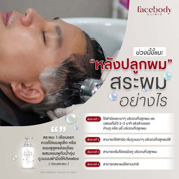 สามารถสระผมได้ทุกวัน แต่ควรเป็นไปตามคำแนะนำของเจ้าหน้าที่คลินิก ตลอดจนใช้แชมพูสูตรอ่อนโยนในช่วง 2 สัปดาห์แรก เพื่อพ้นระยะเวลาดังกล่าวแล้ว ก็สามารถสระผมได้ตามปกติ และใช้ชีวิตได้ตามปกติโดยไม่ต้องระวังอะไรมากแล้ว รวมถึงการใช้เซรั่มบำรุงหนังศีรษะต่างๆ ก็สามารถใช้ได้หลังจากปลูกผม 2 สัปดาห์เช่นกัน